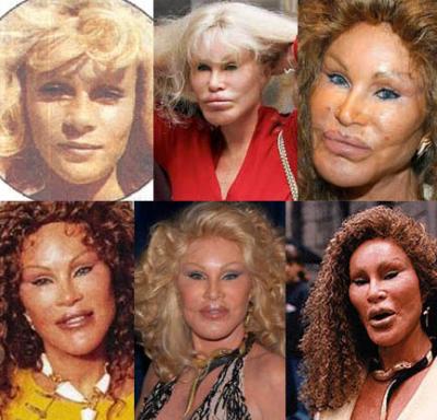   Plastic Surgery on Which Celeb Has The Best Plastic Surgery    Page 5